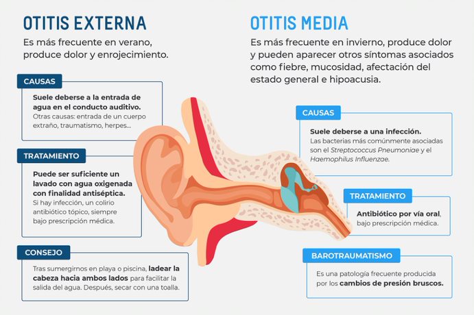 Otitis O Infección De Oído Qué Es Y Cuáles Son Sus Síntomas 